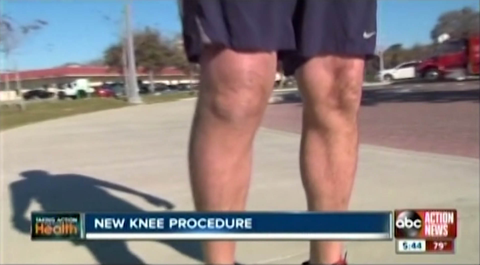 ABC News Patient Story - Signature Knee Replacement