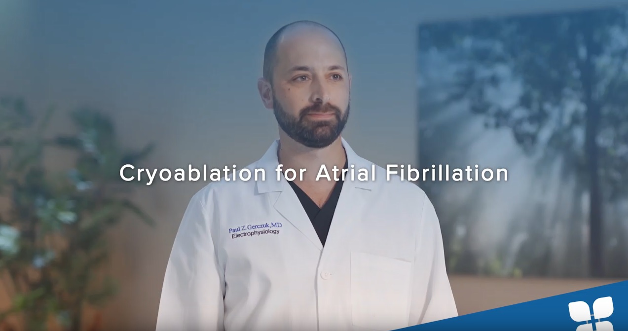 Cryoablation for Atrial Fibrillation
