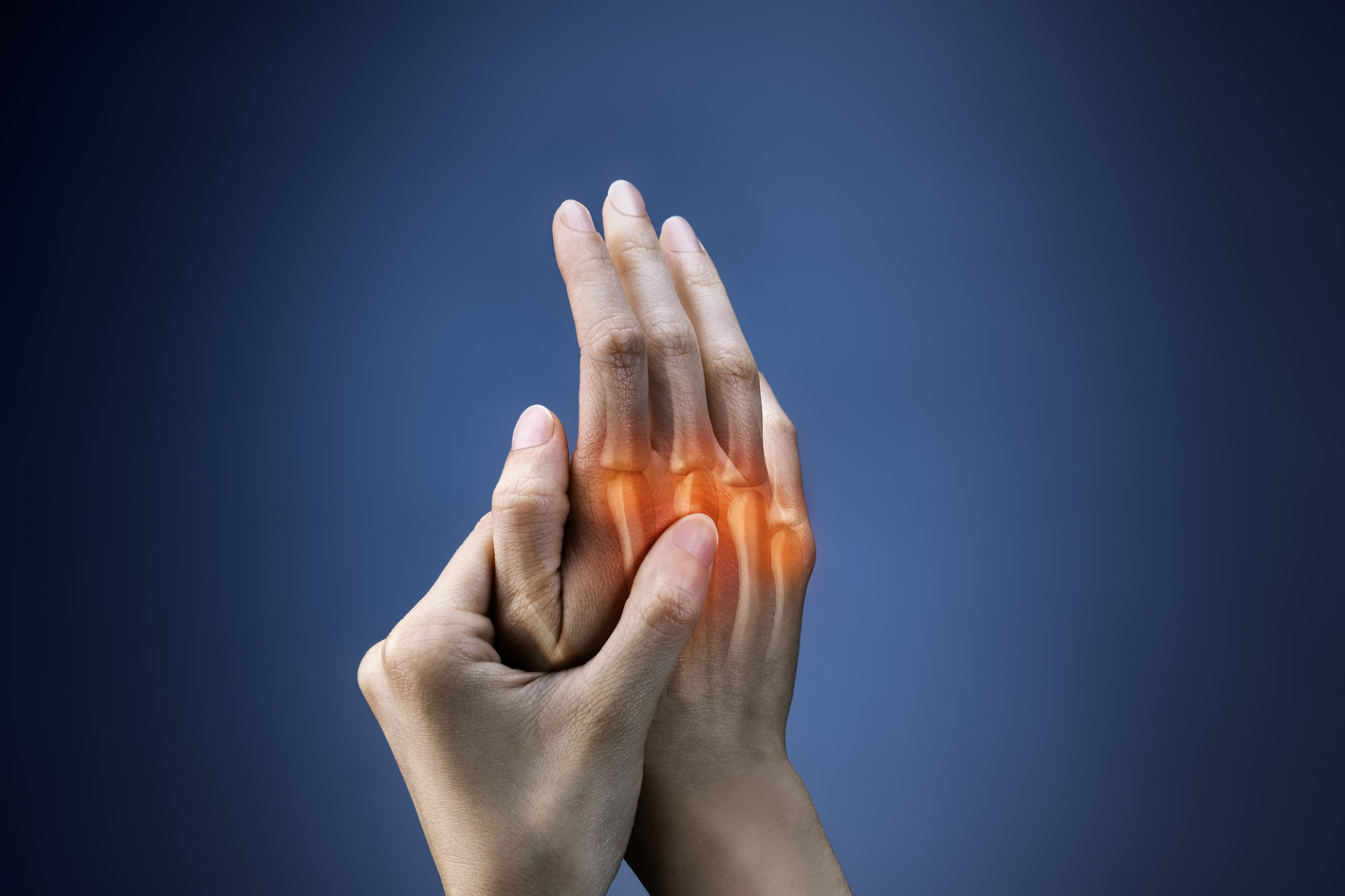 Psoriatic Arthritis Symptoms, Causes, & Treatment Florida Medical Clinic Orlando Health Blog