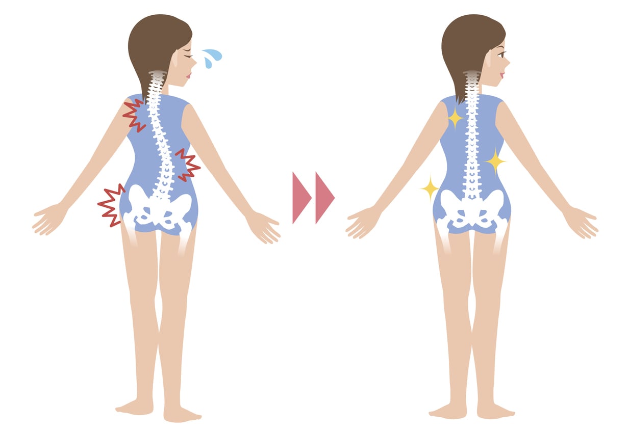 a graphic that depicts what a spine looks like before a person has spine surgery