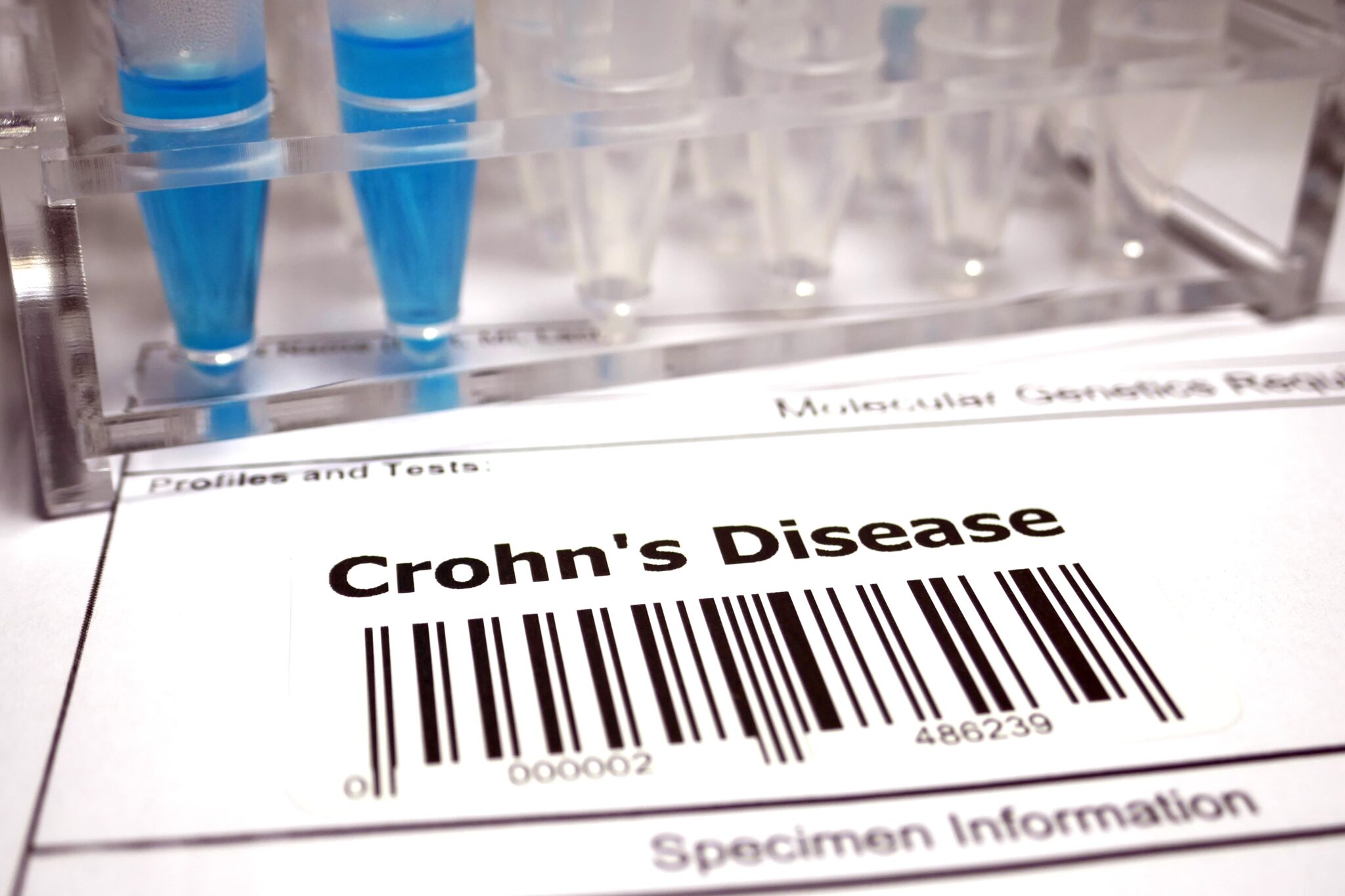 crohn's disease and barcode on a piece of paper indicating a patient has IBD