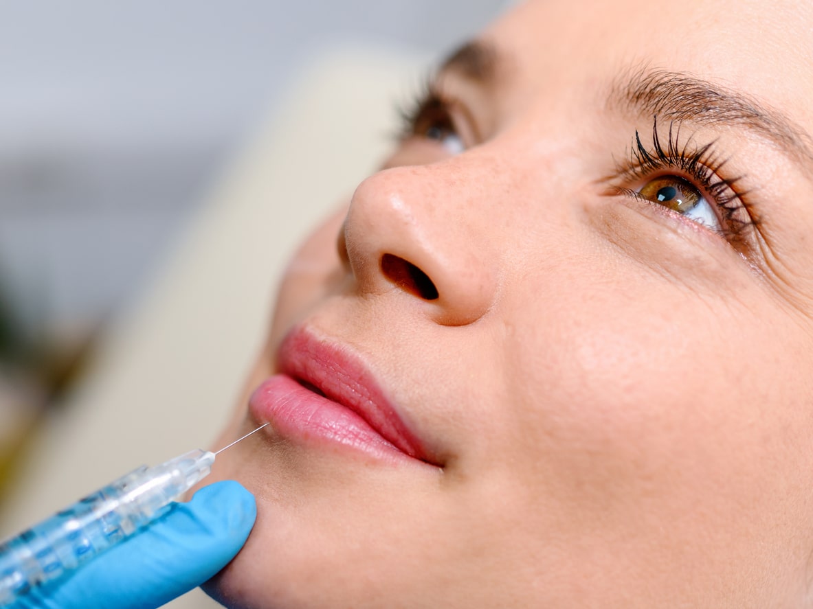 a doctor giving a woman dermal filler in her lips